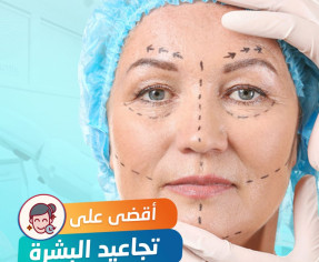 أقوى حل للقضاء علي التجاعيد.