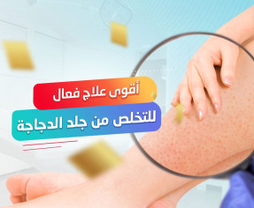 كورس علاج جلد الوزة عروض البلاك فرايداي