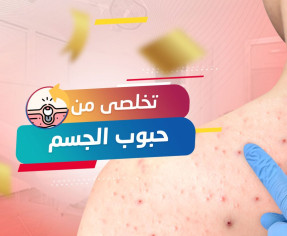 كورس علاج حبوب الجسم عروض البلاك فرايداي