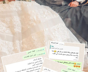 عروس تخلصت من المناطق الداكنة قبل الزفاف ب 20 يوم فقط