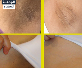 اقوى كورس لتفتيح المناطق الحساسة