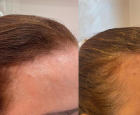 حافظي علي جمالك بالصيف