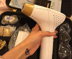 كيف تخلصت من عصابات عيادات الليزر الي نهبو اموالي بدون داعي