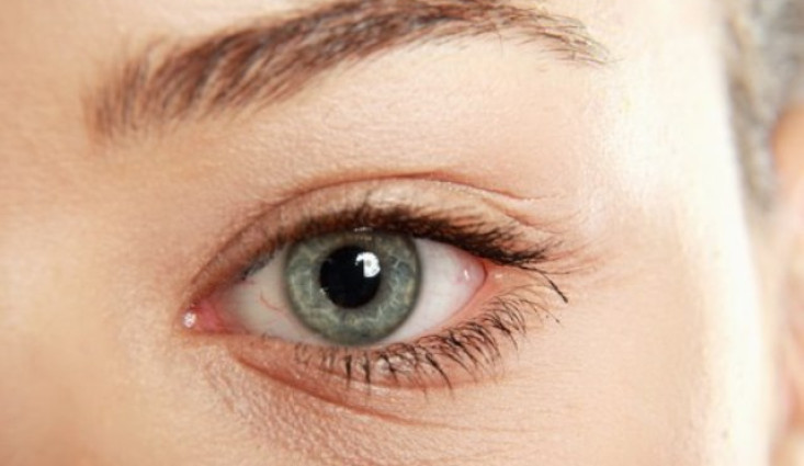 أشهر أسباب ظهور تجاعيد تحت العين عند