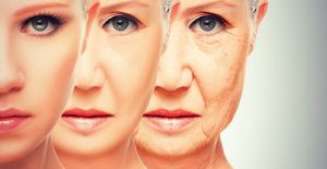 How-To-Reduce-Wrinkles-Naturally-300x155