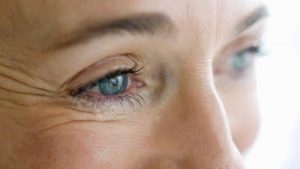 علاج تجاعيد العين طبيعيا