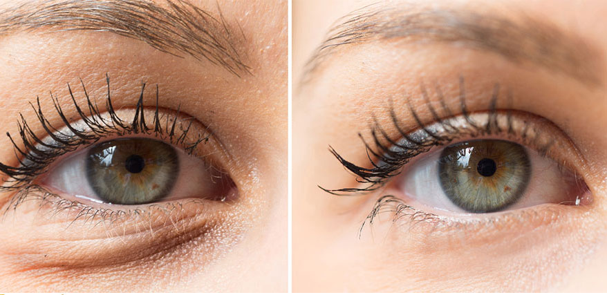 تعرفي على كيفية إزالة التجاعيد تحت العين