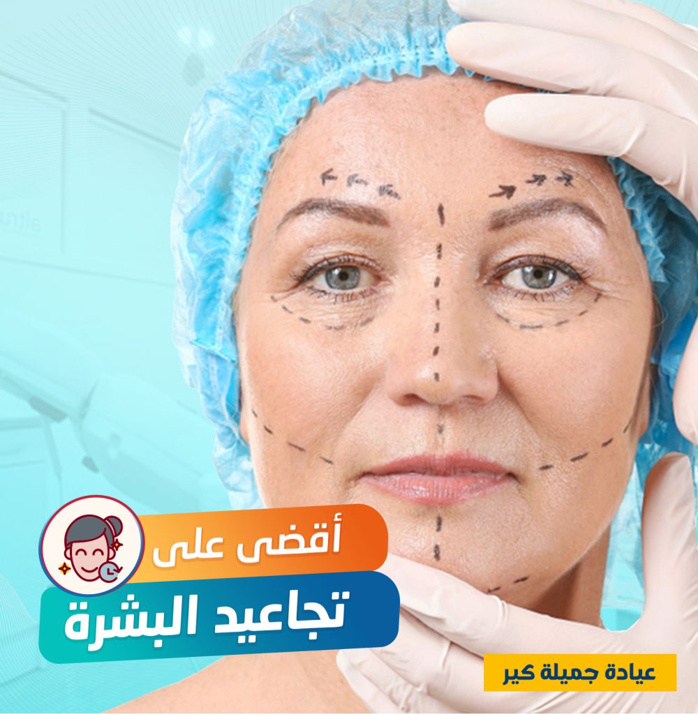 أقوى حل للقضاء علي التجاعيد.