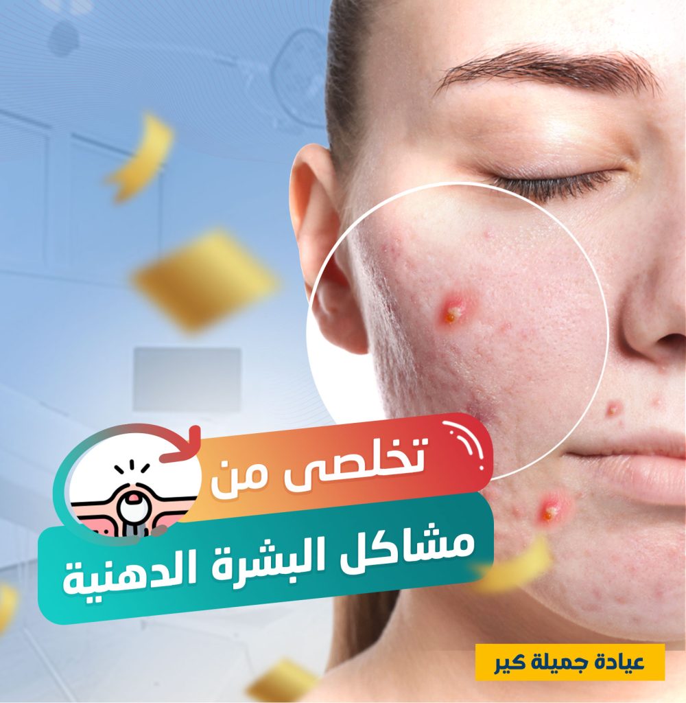 كورس العناية بالبشرة الدهنية عروض البلاك فرايداي