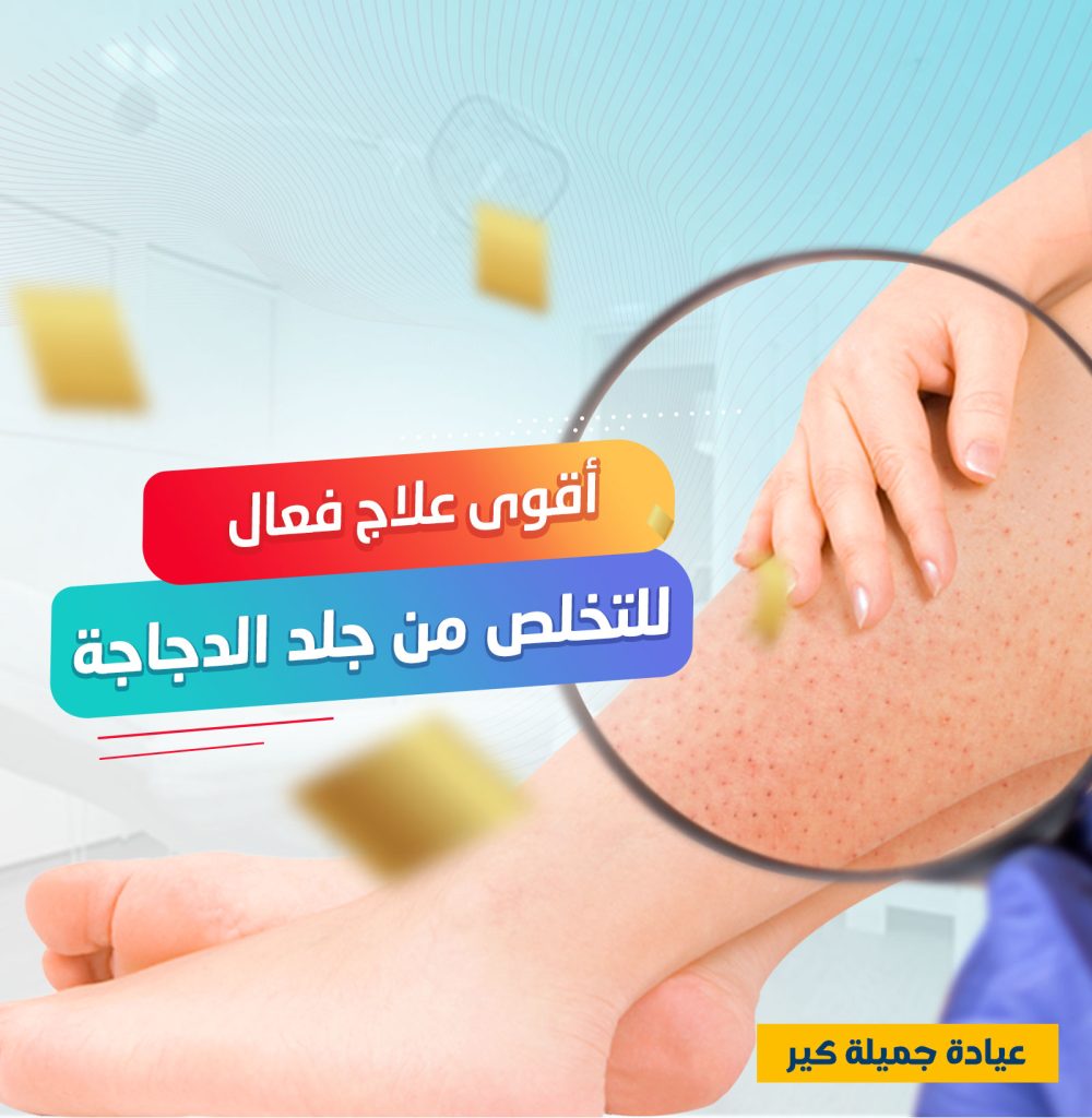 كورس علاج جلد الوزة عروض البلاك فرايداي كورس علاج جلد الوزة عروض البلاك فرايداي