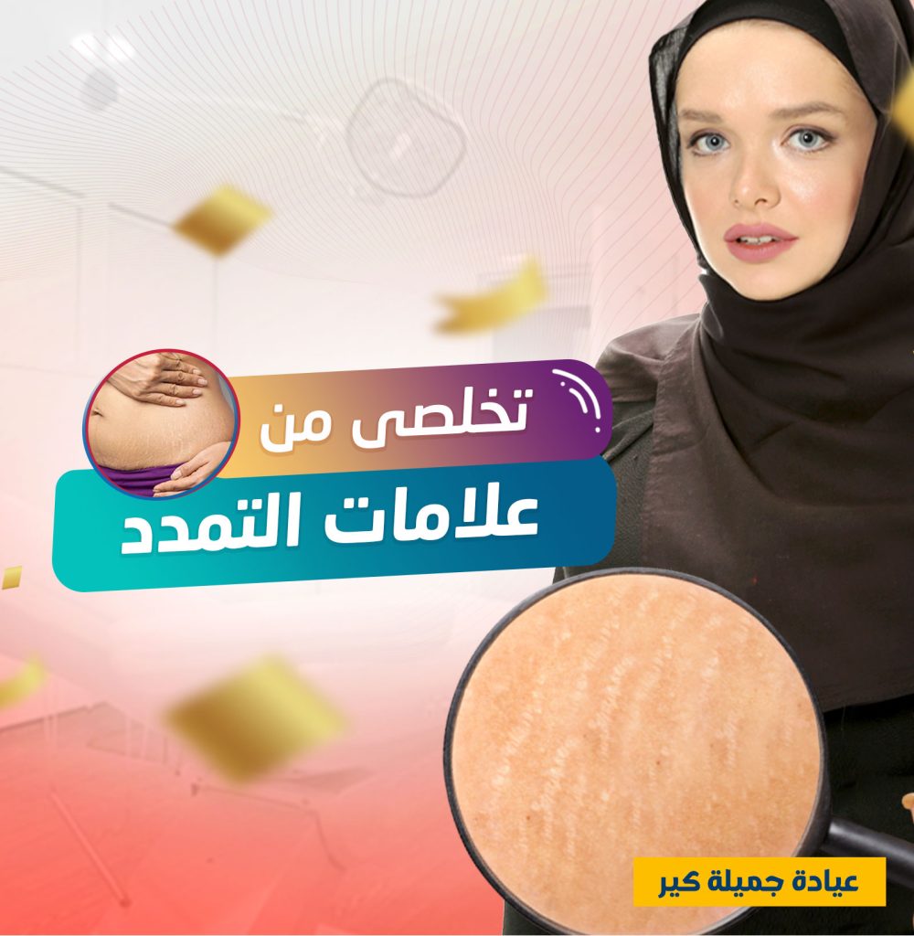 كورس علاج علامات تمدد الجلد عروض البلاك فرايداي
