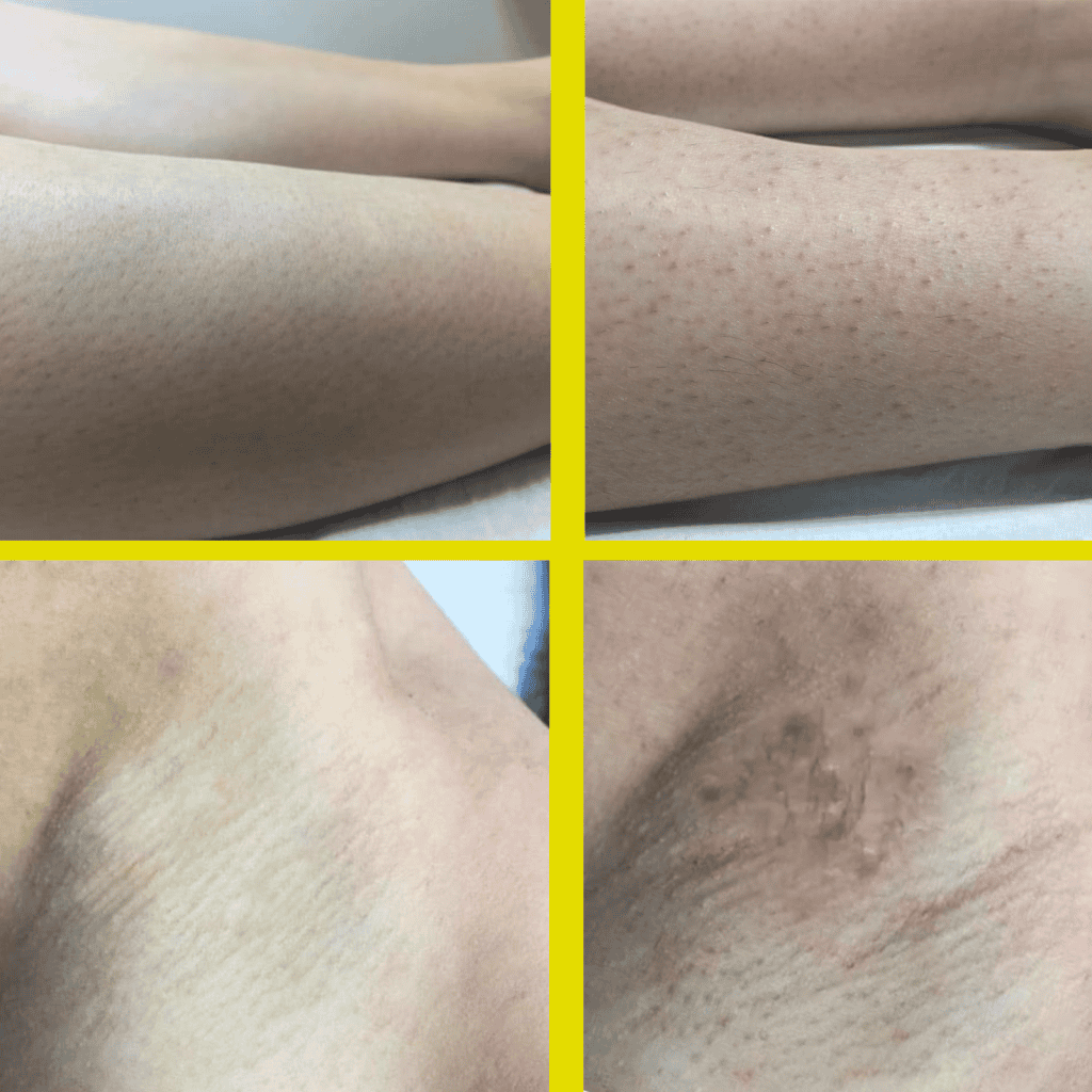 أقضي على جلد الدجا-جة للابد