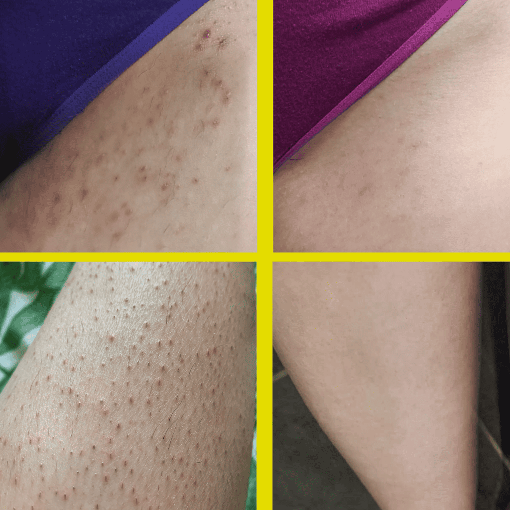 تأخير نمو الشعر 10 مرات أكثر من الطبيعي بدون آثار جانبية