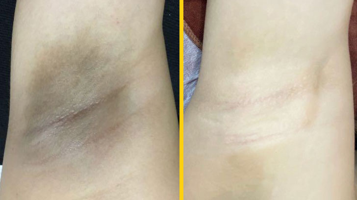 النهاية السعيدة لإسمرار المناطق الحساسة للمتزوجين و العروس في أسرع وقت